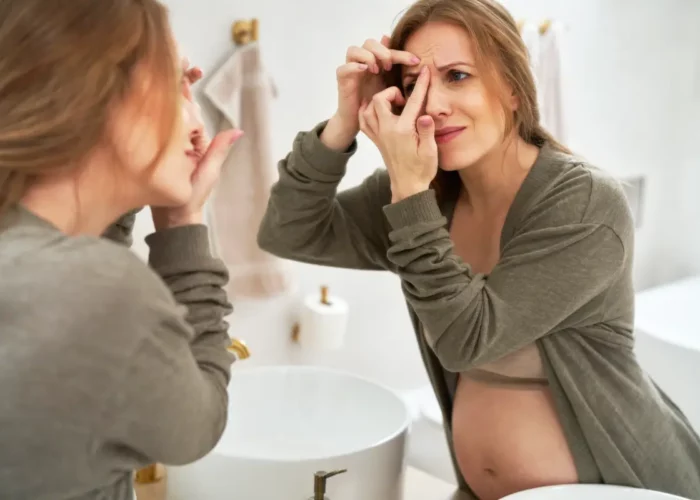 L’acné de grossesse : comment la traiter naturellement ?