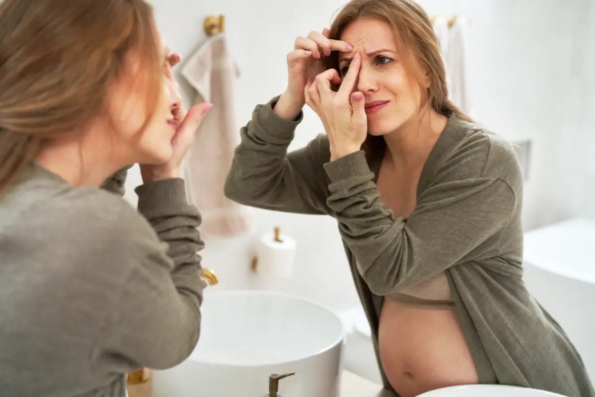 L’acné de grossesse : comment la traiter naturellement ?